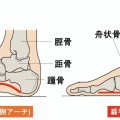 アーチ