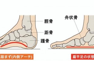 アーチ